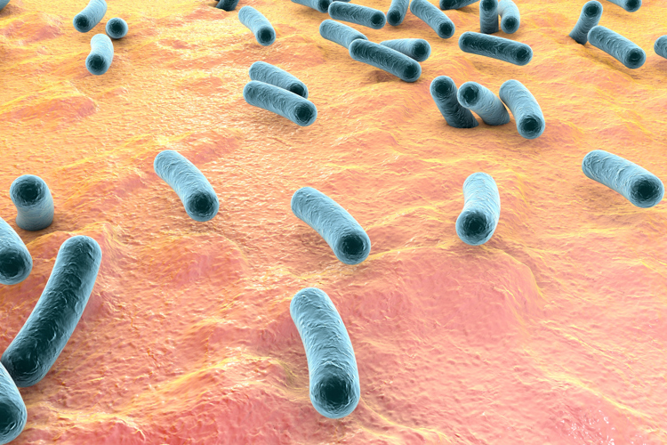 Legionella
